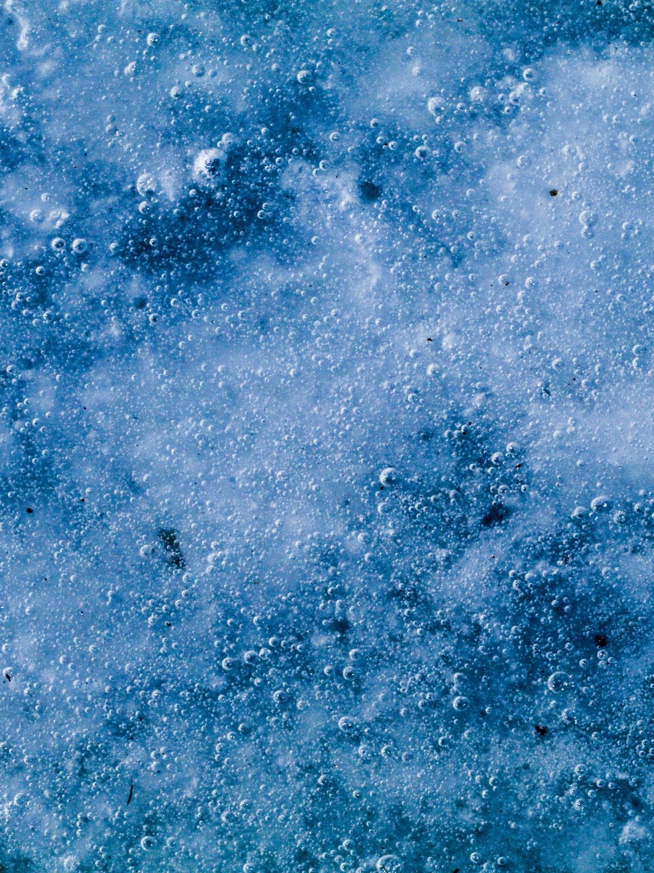 cryolipolyse à Nice